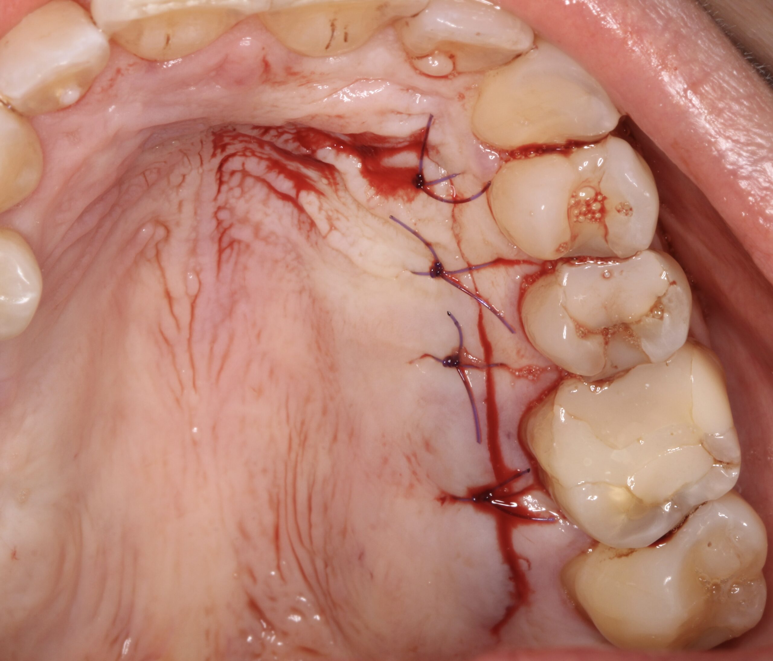 Figure 21. 