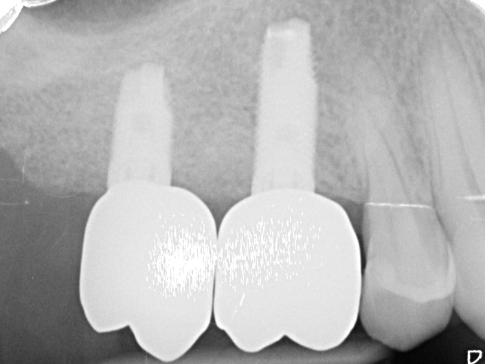 Figure 24. 