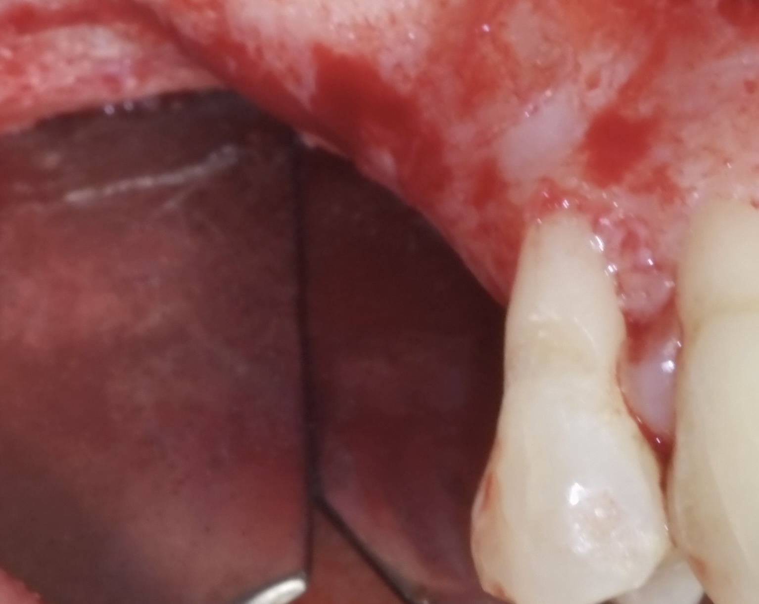 Figure 3. 